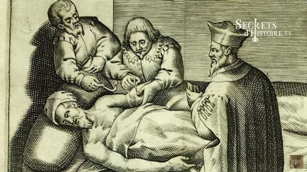 La variole, une épidémie dévastatrice - Secrets d'Histoire Officiel